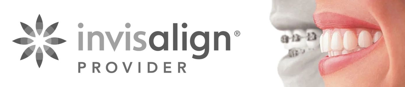 invisalign